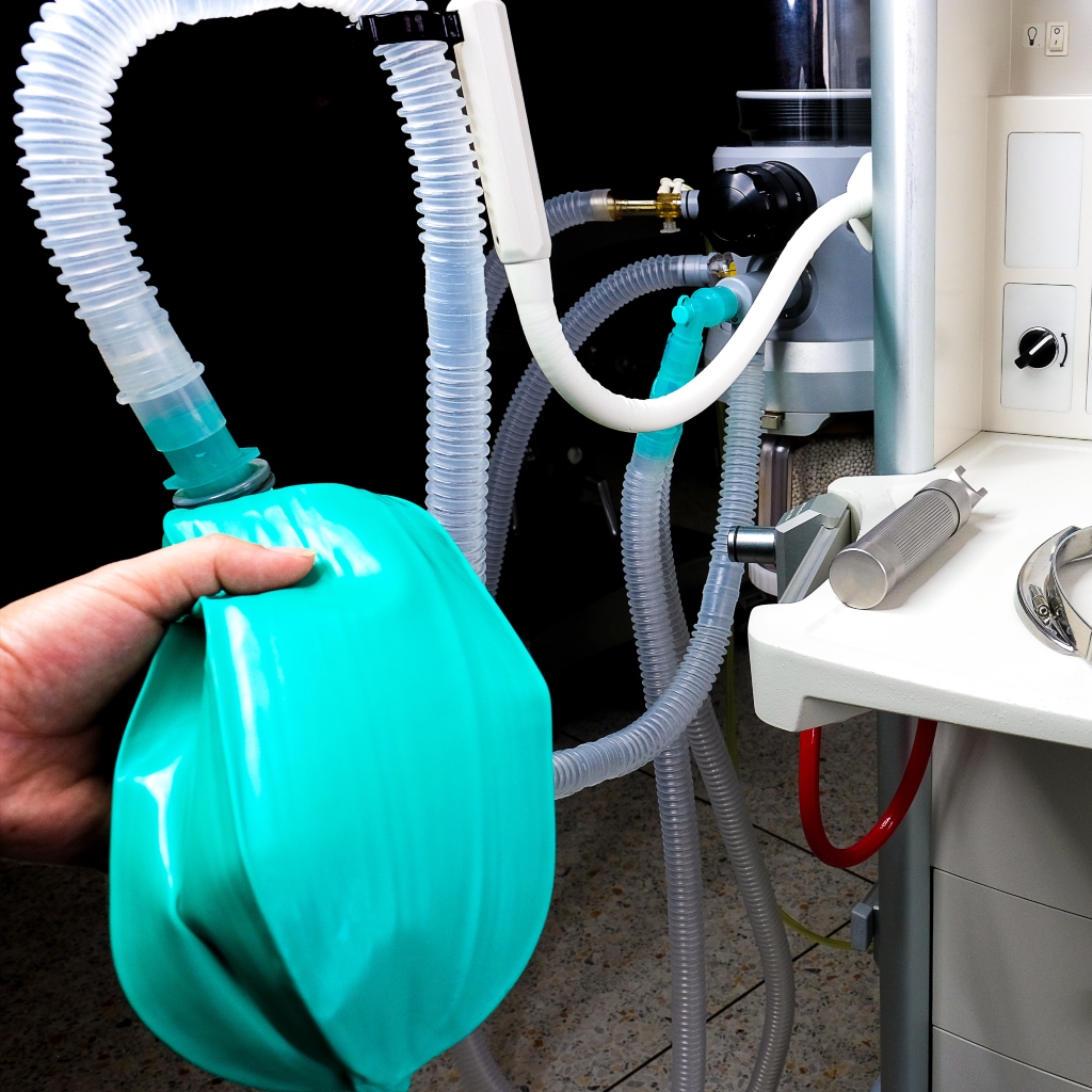 Bag valve mask ventilation in anesthesia induction - DocCheck